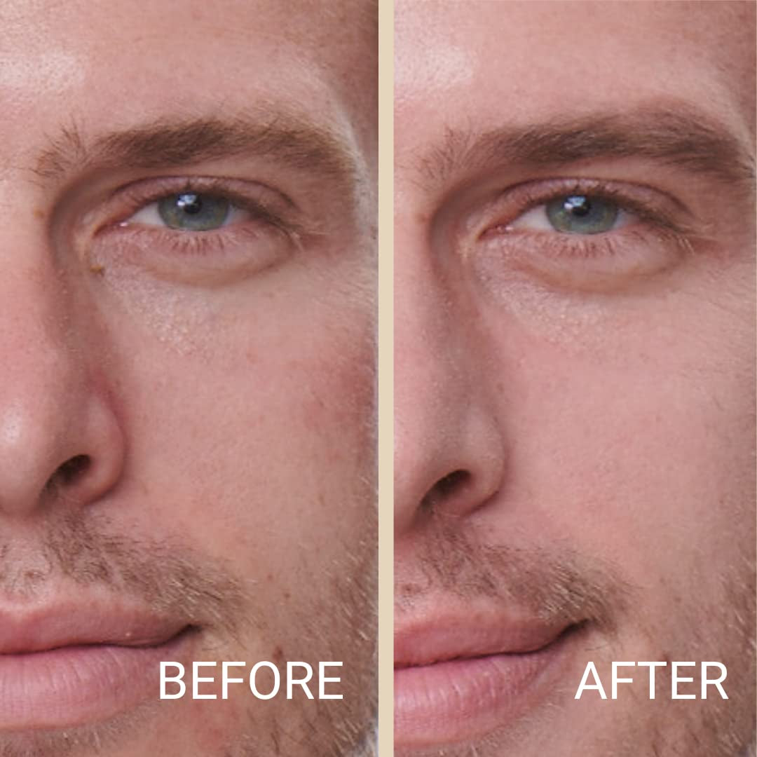 Skin Fix - Luxury - Easy for Men - Tinted Concealer - Visibly Covers Fine Lines, Under-Eye Bags, Razor Burns, Pimples - Vegan Makeup - Perfect for Gym Bag or Travel - 15G (F1)