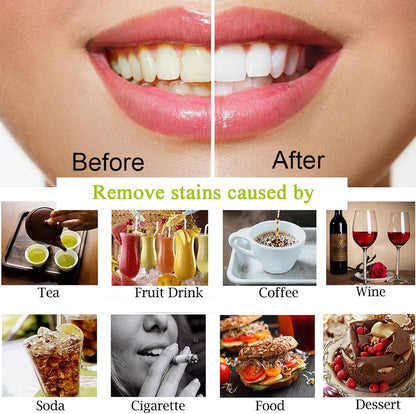 Teeth Whitening Charcoal Powder, Teeth Whitener Powder Oral Care Sets Natural Coconut, No Hurt on Enamel or Gum (1)